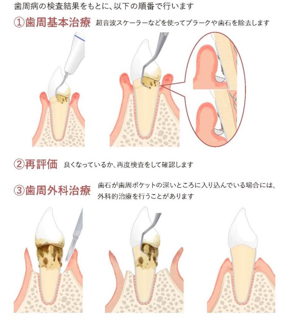 倉敷市で歯科をお探しの方【矢部歯科医院をおすすめする理由】 | 矢部歯科医院【倉敷市連島・水島・玉島の歯医者】