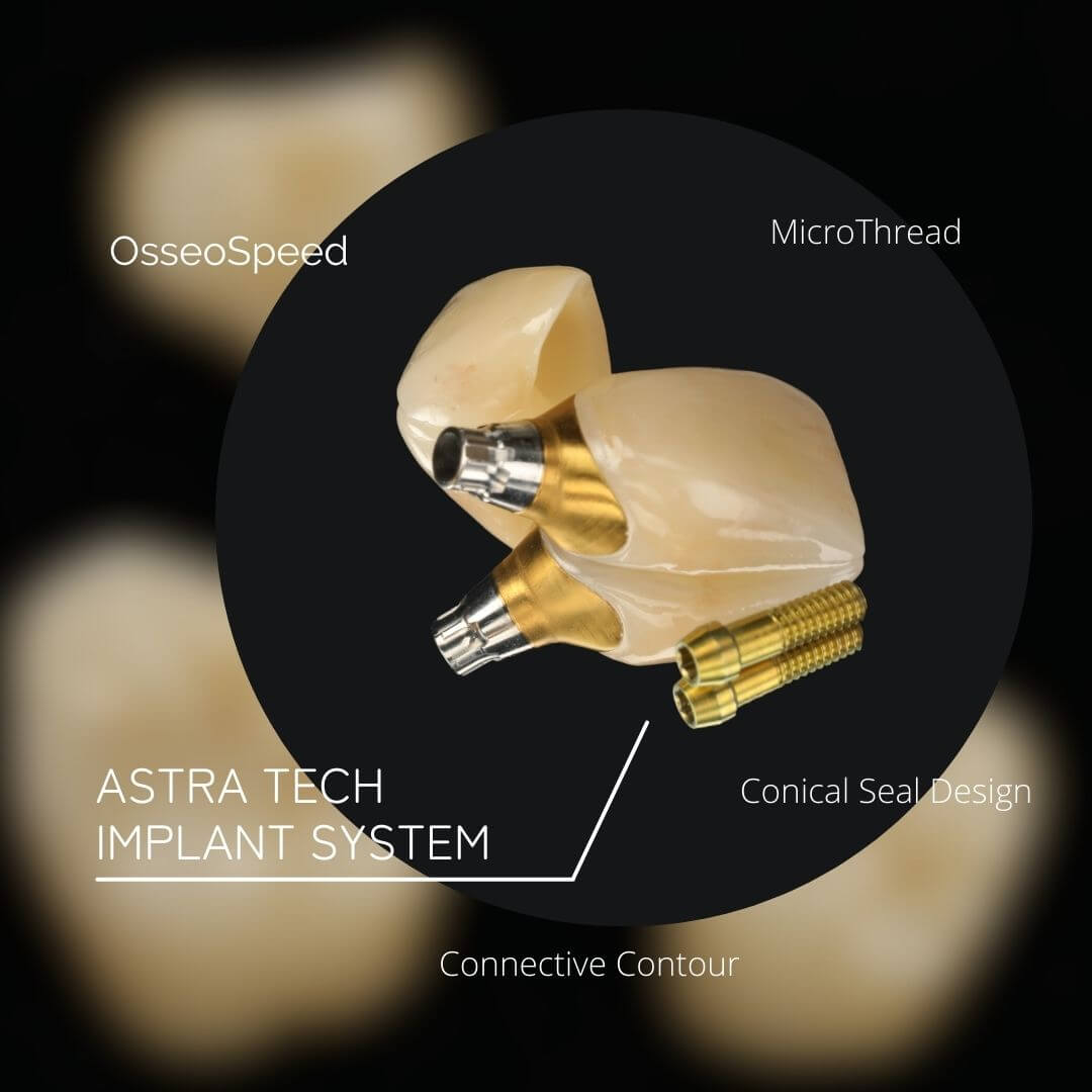 矢部歯科医院【倉敷市連島・水島・玉島の歯医者】